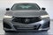 2025 Acura TLX Technology Package